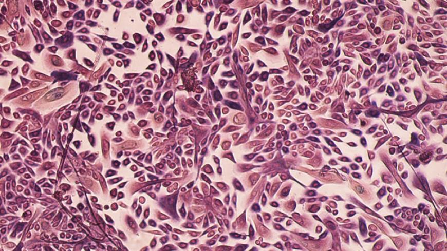 Клетки рака молочной железы