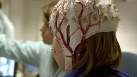 Неврология