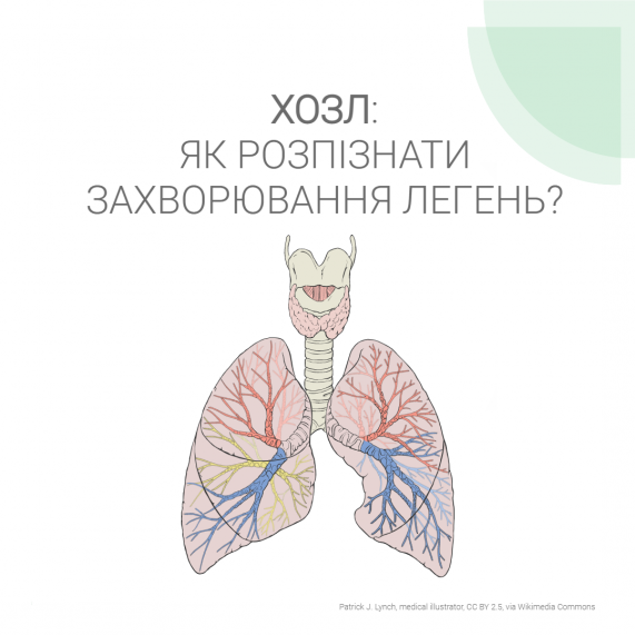 ХОЗЛ: як розпізнати захворювання легень?
