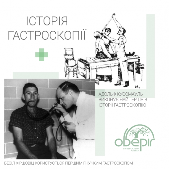 Історія гастроскопії