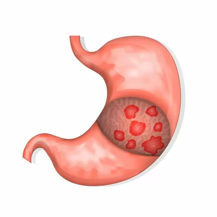 Хвороби і стани