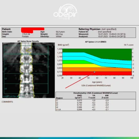 Що таке денситометрія?
